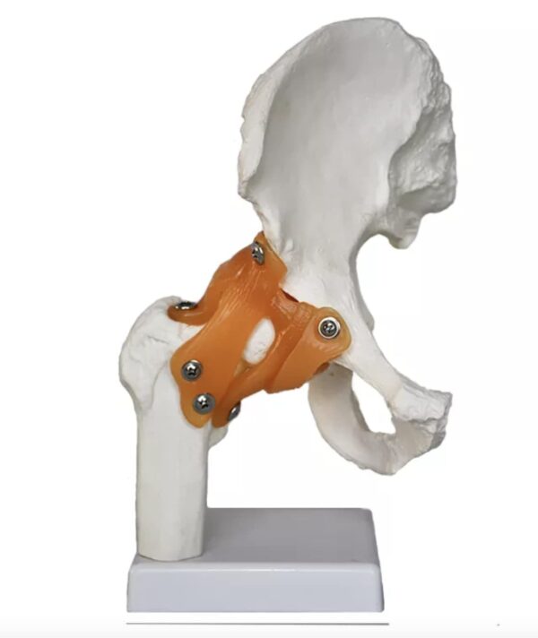 Human Hip Joint Model with Ligaments ✮ Scientific Life Size with Premium Display Base ✮ Best Teaching Tool for Patient Education & Anatomy Study .MANNHEAL