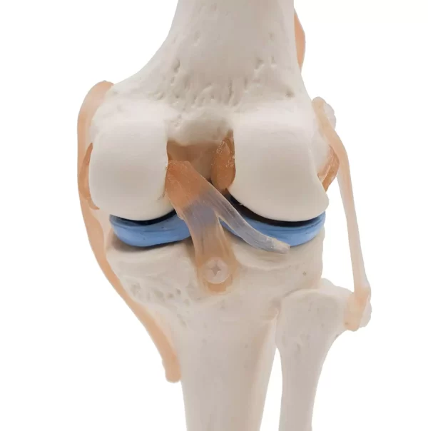 Knee Joint model With Ligaments PVC, Fiber, Silicone Material .MANNHEAL